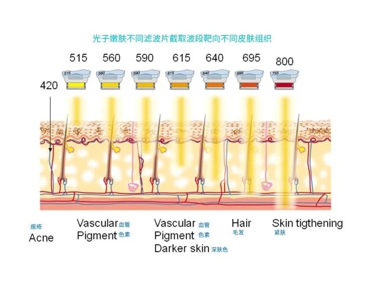 五大光子嫩膚技術(shù)（IPL、DPL、OPT、APT、BBL）及濾光片區別